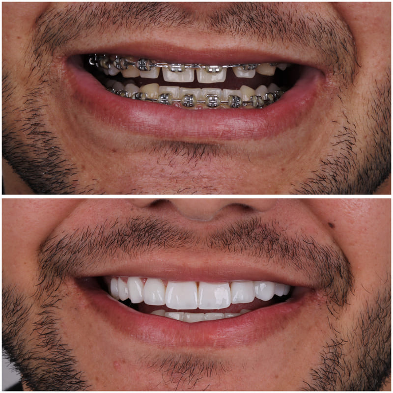 9EF4D68E-812D-49A5-86D7-8592374E30A9