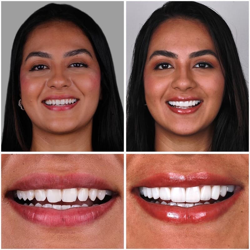 C2B216D1-F2BE-48CB-8E32-CD1A6AC325EE